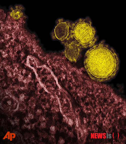 【NIAID=AP/뉴시스】미국 국립 로키마운틴연구소가 제공한 정확한 촬영 날짜가 알려지지 않은 사진으로, 전자현미경으로 찍은 호흡기 질환 '메르스'(MERS: 중동호흡기증후군) 바이러스의 사진(노란색 부분). 사우디아라비아를 비롯한 중동 지역에서 집중적으로 발생한 이 전염병은 이미 38명의 목숨을 앗아 갔고, 질병 전문가들은 사스(중증급성호흡기증후군)보다 더 치명적이라고 밝혔다. 2013.06.20 