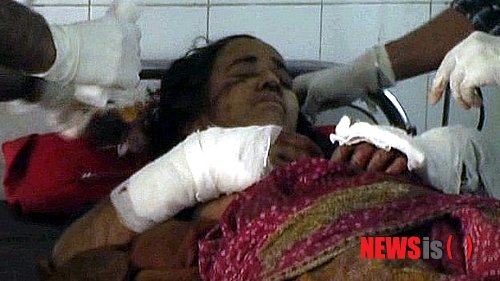 【서울=뉴시스】인도 북부 우타르칸드주에 거주하는 캄라 데비라는 56살의 여성이 지난 24일 표범의 공격을 받았지만 약 30븐 간의 사투 끝에 표범을 죽이고 구사일생으로 목숨을 건져 화제가 되고 있다. 사진은 병운에서 치료를 받고 있는 데비의 모습. <사진 출처 : 英 BBC 웹사이트> 2014.8.27