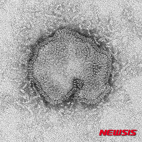 【베이징=AP/뉴시스】중국 질병통제예방센터가 제공한 전자현미경으로 포착한 신종 H7N9형 조류 인플루엔자(AI) 바이러스.                  