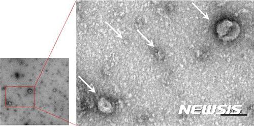 【수원=뉴시스】 미세유체분리기술을 통해 손상 없이 분리된 엑소좀(화살표)의 전자현미경 사진. 2017.09.06. (사진=차세대융합기술연구원 제공) photo@newsis.com