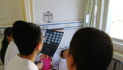 【서울=뉴시스】중국 산시성 퉁촨지역에서 살고 있는 41세 여성의 폐 속에서 3cm 길이의 고추가 발견됐다. 이 여성은 원인을 모른 채 6년동안 발열과 호흡 곤란에 시달렸으며, 고추는 수술을 통해 제거됐다. (출처 = 화상보) 2018.01.12.