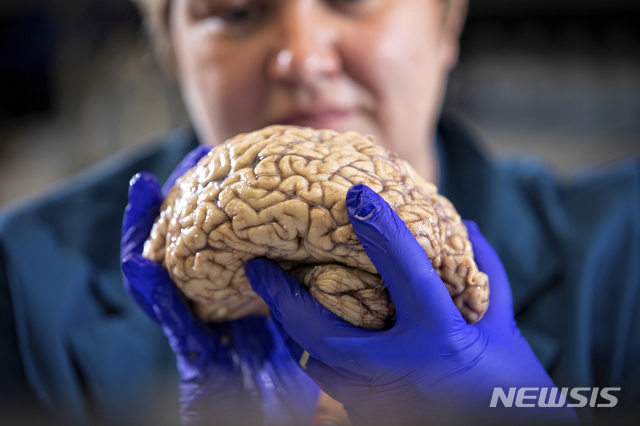 【AP/뉴시스】 미국 텍사스주에서 '뇌 먹는 아메바'에 감염된 10세 소녀가 사망했다고 16일(현지시간) CNN이 보도했다. 사진은 켄터키대학이 AP에 제공한 사진으로 도나 윌콕 박사가 연구실에서 뇌를 들고 있는 모습. 2019.09.17.