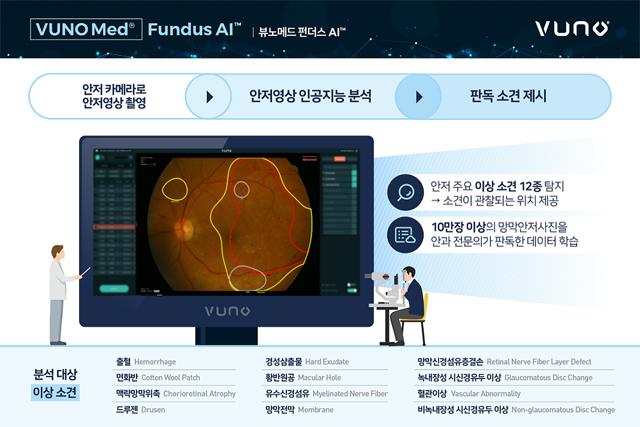 [서울=뉴시스] 뷰노메드 펀더스 AI™ 제품(사진=뷰노 제공)