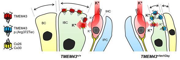 [대전=뉴시스]TMEM43의 분자적 메커니즘 모식도. 건강한 달팽이관(왼쪽)의 경우 달팽이관 지지세포 중의 하나인 IBC의 크기가 점차 커지는 반면 TMEM43 돌연변이가 있는 달팽이관(오른쪽)은 IBC의 크기가 커지지 않는다. *재판매 및 DB 금지