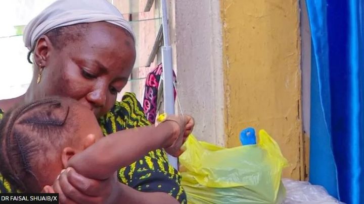Nigeria, épidémie de diphtérie, plus de 600 décès :: Médias sympathiques Newsis News Agency ::