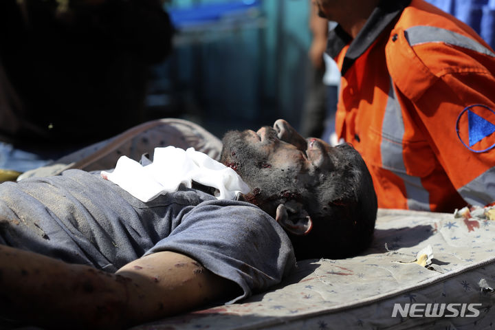 [라파=AP/뉴시스] 7일(현지시각) 이스라엘의 가자지구 포격으로 심하게 다친 남성이 라파 난민캠프에 있는 쿠웨이트 병원으로 이송되고 있다. 이스라엘과 하마스가 '지속 가능한 평온' 문구 해석을 놓고 간극을 보이는 가운데 이날 협상을 재개하기 위해 대표단이 이집트로 모였다. 2024.05.08.