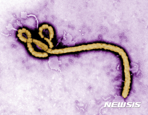 【AP/뉴시스】미국 질병통제 예방센터가 제공한 에볼라 바이러스의 사진. 2017.05.17