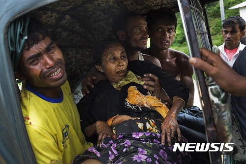 【카투팔롱(방글라데시)=AP/뉴시스】방글라데시의 국경마을 카투팔롱 인근에서 지뢰를 밟아 오른쪽 다리가 절단된 로힝야족 여성이 가족들과 함께 차량으로 병원에 이송되고 있다. 지중해에서 수만명의 이주자들을 구조했던 지원단체 해안이주자지원처(MOAS)는 지중해에서의 구조 활동을 중단하고 대신 미얀마를 탈출하는 로힝야족 구조 활동에 초점을 맞출 것이라고 말했다. 2017.9.5