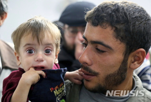 【두마=AP/뉴시스】지난 11월 12일 시리아 반군 장악 지역인 동부 구타 두마에서 한 남성이 영양실조에 걸린 아이를 안아 보여주고 있다. 2017.12.27.