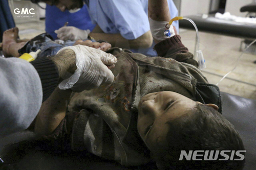 【GMC·AP/뉴시스】시리아 반정부 매체인 구타 미디어 센터(GMC)가 10월31일 제공한 어린이 환자의 모습. 구타는 정부군에 의한 오랜 봉쇄로 인도적 위기를 겪고 있다. 2017.12.15