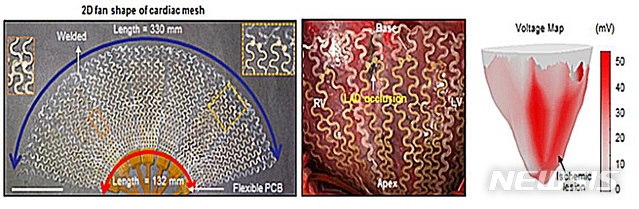 【대전=뉴시스】김양수 기자 =이번 연구에서 IBS 연구진은 여러 층으로 구성된 그물 형태로 금-은나노복합체를 설계해 돼지의 심장에 감아 심장 전체의 신호를 읽는데 성공했다. 사진은 금-은나노복합체를 이용한 다채널 심장 메쉬 디바이스.2018,08.14(사진=IBS 제공) photo@newsis.com