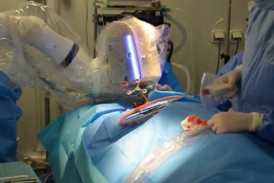 수술에 사용되고 있는 의료용 로봇 (사진=AOT Carlo)