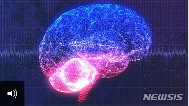 【서울=뉴시스】미국 샌프란시스코의 캘리포니아 대학 연구팀이 사람의 마음을 읽고 생각을 말로 바꾸어줄 수 있는 뇌 이식 장치를 개발했다고 영국 BBC 방송이 24일(현지시간) 보도했다. <사진 출처 : BBC> 2019.4.25