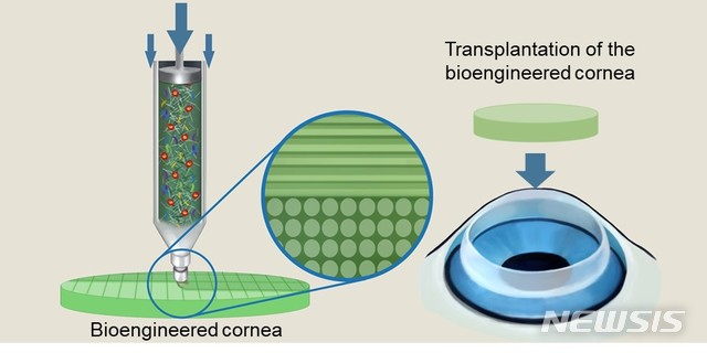 【포항=뉴시스】강진구 기자 = 포스텍(총장 김도연)은 기계공학과 조동우 교수와 창의IT융합공학과 장진아 교수팀이 경북대 의대 안과 김홍균 교수팀과 공동연구를 통해 탈세포화된 각막 조직과 줄기세포를 섞어 만든 바이오잉크를 사용해 3D 프린팅 기술로 인공 각막을 제작하는 데 성공했다고 14일 밝혔다.사진은 관련 연구흐름도.2019.05.14.(사진=포스텍 제공) photo@newsis.com