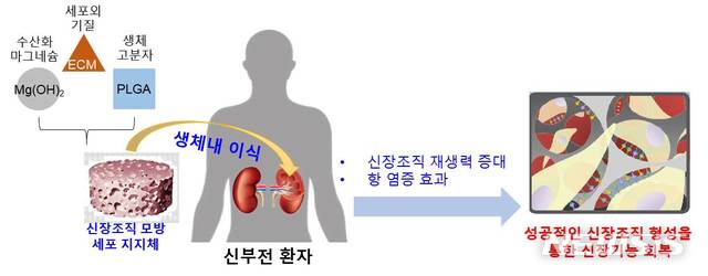 【서울=뉴시스】생체모방과 나노기술를 이용한 신장조직 재생용 지지체. 이 연구에서는 실제 신장조직 구조를 모방한 지지체를 개발함으로써 손상된 신장의 재생을 촉진시키는 전략을 수립했다. 다양한 성장인자가 포함되어 있고 신장조직과 유사한 특성을 가진 세포외기질(ECM)를 첨가하였다. 또한 pH 중화 효과가 있는 수산화마그네슘(Mg(OH)2)도 첨가하였다. 세포외기질은 손상된 신장조직에서 세포 성장 및 분화를 유도할 수 있고, 수산화마그네슘은 낮은 pH로 산성화된 신장조직 내 환경을 pH중화시켜 염증반응을 현저히 억제할 수 있었다.(그림/한동근 교수·박우람 교수(차의과학대학교) 연구팀 제공) photo@newsis.com