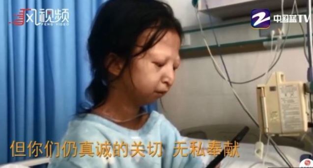 [서울=뉴시스] 극빈생활로 인해 24세 나이에도 불구하고 20kg의 몸무게를 가진 중국 여성 우화옌의 사연이 지난해 10월 중국 TV방송을 통해 보도되고 있는 장면. 영국 BBC는 병원 입원 치료에도 불구하고 우화옌이 결국 13일에 사망했다고 보도했다 .2020.01. 15
