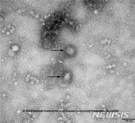 현미경으로 확대한 코로나바이러스. 표면에 돌기가 형성된 왕관 모양이다.