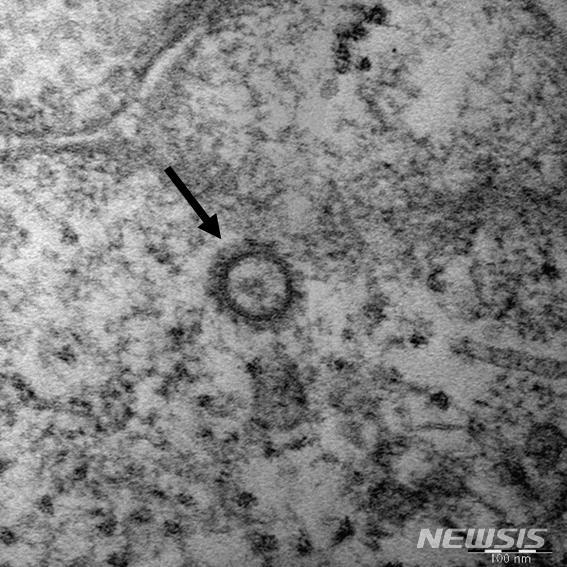 [세종=뉴시스]임재희 기자 = 신종 코로나바이러스(SARS-CoV-2) 입자를 전자 현미경으로 확대한 모습. 입자 크기는 80~100㎚(나노미터). ㎚는 1000만㎝분의 1에 해당하는 크기다. (사진=질병관리본부 제공) 2020.02.27. photo@newsis.com 