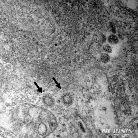 [세종=뉴시스]임재희 기자 = 신종 코로나바이러스(SARS-CoV-2) 입자를 전자 현미경으로 확대한 모습. 입자 크기는 80~100㎚(나노미터). ㎚는 1000만㎝분의 1에 해당하는 크기다. (사진=질병관리본부 제공) 2020.02.27. photo@newsis.com 