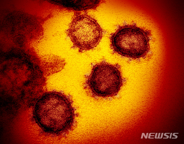 [AP/뉴시스]지난 2월 미 국립보건원(NIH)이 전자현미경으로 관찰한 신종 코로나바이러스 감염증(코로나19) 바이러스의 모습. 2020.4.28