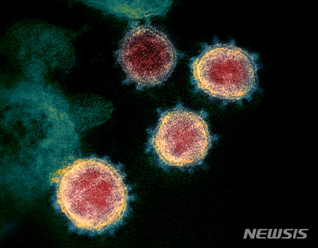 [AP/뉴시스] 성가대 수퍼전파자가 퍼뜨린 코로나19 바이러스 . 이 사진은 미 국립보건원이 올해 2월에 환자에게서 채취해 촬영한 샘플이다. 