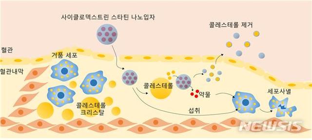 코쿠사키 바이러스와 만성 심혈관 질환: 심부전과 아테롬성 동맥경화의 진행