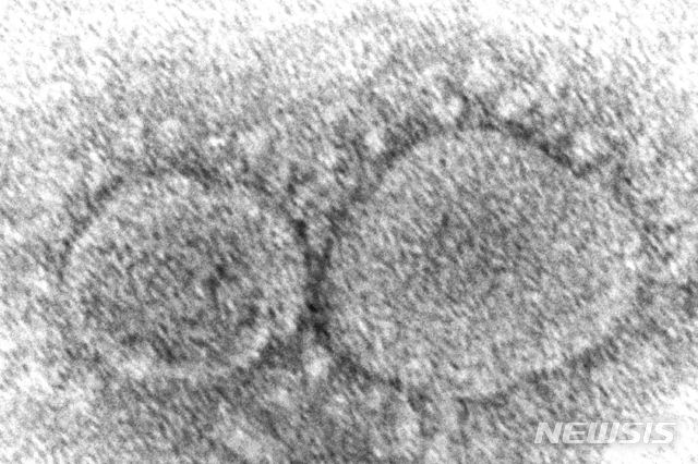 [AP/뉴시스]미국 질병통제예방센터(CDC)가 제공한 코로나19 바이러스 초기 입자의 전자 현미경 이미지.