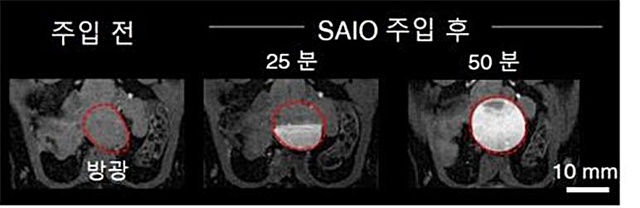 [대전=뉴시스] SAIO 조영제는 MRI 촬영 후 소변으로 완전히 배출된다. 시간이 지남에 따라 SAIO가 방광으로 모이는 것과 방광에 모인 SAIO가 소변으로 배출되는게 확인된다. *재판매 및 DB 금지