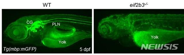 [서울=뉴시스] 연구팀에 따르면 ‘EIF2B3’ 유전자 결핍 동물모델(오른쪽)은 그렇지 않은 동물모델(왼쪽)에 비해 신경계 미엘린 생성 결핍 증상을 보였다. (사진= 세브란스병원 제공) 2021.03.22