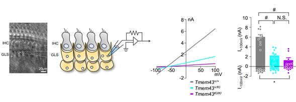 [대전=뉴시스]TMEM43의 병리학적 메커니즘. 쥐의 달팽이관 지지세포(GLS)에서 전기 신호를 측정한 결과, 정상적인 쥐(회색)와 달리 TMEM43 돌연변이 형질 변환 쥐에서는 전기신호가 우성 음성으로 줄어들어 있다. *재판매 및 DB 금지