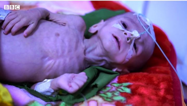 [서울=뉴시스]아프가니스탄 서부 헤라트의 한 병원에서 6개월 된 영아가 신소호흡기에 의존한 채 위태롭게 생명을 이어가고 있다. (사진=BBC 보도 캡처) *재배포 및 DB 금지. 2021.10.27 
