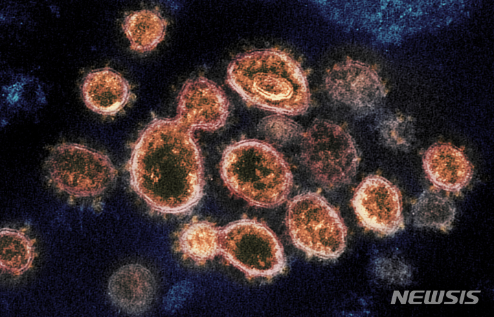 [AP/뉴시스]미 국립알레르기·전염병연구소(NIAID) 로키마운틴연구소가 제공한 코로나19 바이러스의 전자현미경 사진.  2021.10.28