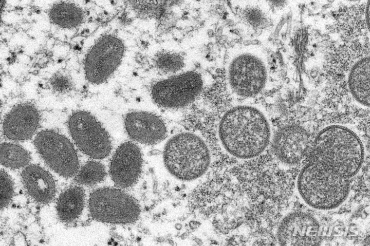[CDC=AP/뉴시스]미국 질병통제예방센터(CDC)가 공개한 이 2003년 전자현미경 사진은 프레리도그(Prairie dog) 발병과 관련된 인간의 피부 표본에서 얻은 것으로, 성숙한 타원형의 원숭이두창 바이러스(왼쪽과)와 원모양의 미성숙한 바이러스(오른쪽)가 찍혀 있다. 2022.07.25.