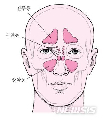 [서울=뉴시스]코의 구조. 부비동이란 콧구멍과 연결돼 얼굴 뼈 안에 있는 빈 공간을 말한다. 머리뼈 안에 있는 뇌를 외부의 충격으로부터 보호해 준다. 종류에는 상악동, 전두동, 사골동 및 접형동이 있다.(이미지= 경희의료원 제공) 2022.07.24