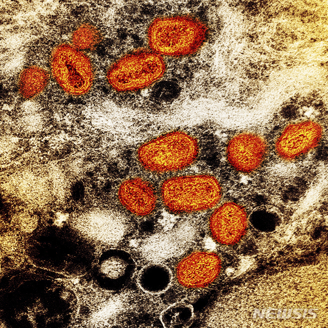 [AP/뉴시스] 미국 국립알레르기감염병연구소(NIAID)가 제공한 사진으로, 실험실에서 배양한 감염된 세포(갈색) 내 원숭이두창 입자(주황색)이 투과전자현미경에서 보이고 있다. 2022.07.31
