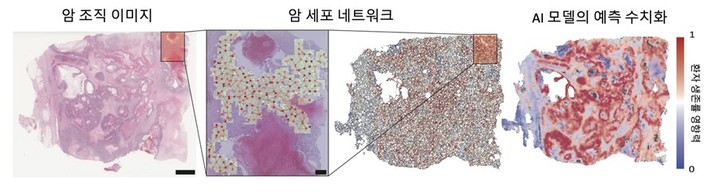 암 조직의 네트워크화와 해석 가능한 그래프 딥러닝의 결과. 사진 서울대학교 *재판매 및 DB 금지