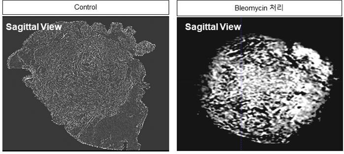 [대전=뉴시스] 인간 줄기세포 유래 3D 폐 오가노이드의 Micro-CT 이미지. *재판매 및 DB 금지