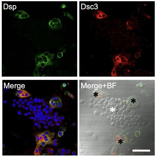 [대전=뉴시스] 세포 리프로그래밍 과정 중 일시적으로 형성되는 중간단계세포에 데스모솜 단백질을 염색한 후 공초점 현미경으로 관찰한 사진. Dsp를 발현하는 중간단계세포(dIC·검은 별표)와 Dsp를 발현하지 않는 과립형 중간단계세포(gIC·하얀 별표)를 확인할 수 있다. *재판매 및 DB 금지