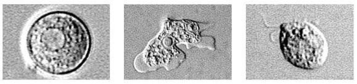 [세종=뉴시스]파울러자유아메바를 현미경으로 확대한 모습. (자료=질병관리청 제공) 2022.12.26.. photo@newsis.com *재판매 및 DB 금지