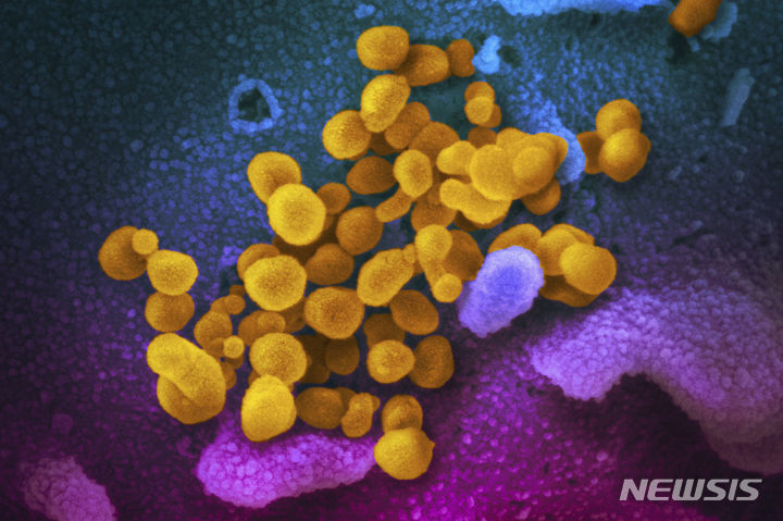 [AP/뉴시스] = 미 국립보건원이 착색 촬영해 2020년 2월 발표한 코로나 바이러스의 전자 현미경 사진. 노란색 부분이 SARS-CoV-2바이러스이며 푸른색과 핑크색은 인체 세포이다. 2023.09.29. 