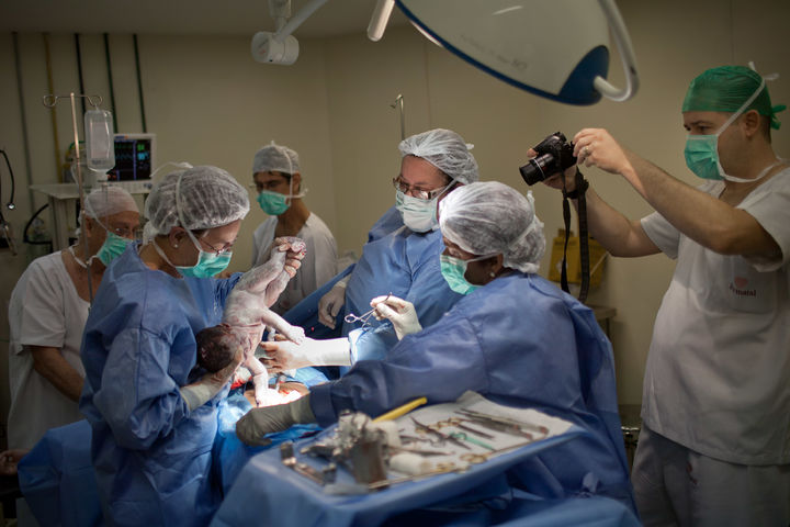 [서울=AP/뉴시스]2012년 8월2일 브라질의 한 산부인과에서 제왕절개 수술로 출산하고 있는 모습. 사진은 기사 내용과 관련 없음 (뉴시스DB) *재판매 및 DB 금지