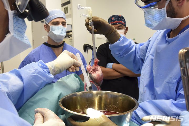 [볼티모어(미 메일랜드주)=AP/뉴시스]미 메릴랜드 의대 외과 의사들이 지난 20일 58살의 로렌스 포셋에게 사상 2번째 인간에 대한 돼지 심장 이식 수술을 준비하고 있다. 의대 측은 수술에 대한 포셋의 초기 반응이 아주 좋아 이틀 만인 22일 농담을 주고받을 수 있을 정도라고 밝혔다. 2023.09.23.