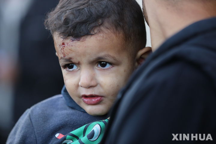 [ 데이르 엘발라(가자지구)=신화/뉴시스]가자지구 중부도시 데이라 엘-발라에서 12월 3일 이스라엘의 공습 재개로 다친 아이가 병원에서 대기하고 있다. 아프리카 튀니지는 군용기를 이용해 가자지구 부상자 20명과 가족 21명을 튀니스로 수송, 치료해주고 있다고 발표했다. 2023.12.04.
