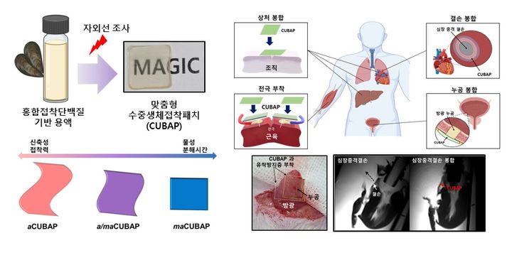 [포항=뉴시스] 강진구 기자 = 포스텍은 화학공학과·융합대학원 차형준 교수와 화학공학과 박사과정 양장우 씨, K-MEDI Hub(대구경북첨단의료산업진흥재단) 신화희 선임연구원, 부경대 스마트헬스케어학부 송강일 교수 공동 연구팀이 홍합에서 유래한 접착단백질(Mussel Adhesive Protein)을 사용해 맞춤형 수중 생체 접착 패치인 CUBAP(Customized Underwater Bio-Adhesive Patches)을 개발했다고 29일 밝혔다.사진은 연구 관련 이미지.(사진=포스텍 제공) 2024.01.29.photo@newsis.com *재판매 및 DB 금지