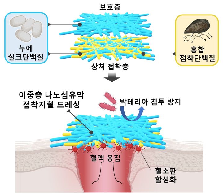 포스텍 연구팀, 홍합과 누에고치로 장기 출혈 막는다