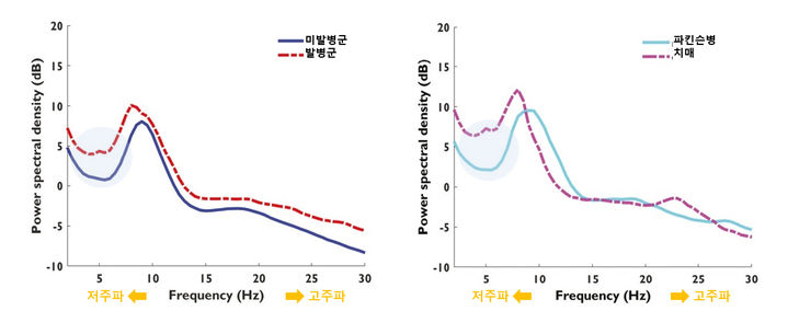 [서울=뉴시스] 2일 서울대병원 신경과 정기영·김한준 교수 및 강동경희대병원 변정익 교수 공동연구팀은 렘수면행동장애 환자의 뇌파를 활용해 신경퇴행성질환 발병 시기와 유형을 예측하는 머신러닝 모델을 개발했다고 밝혔다. (사진=서울대병원 제공) 2024.04.02. photo@newsis.com *재판매 및 DB 금지