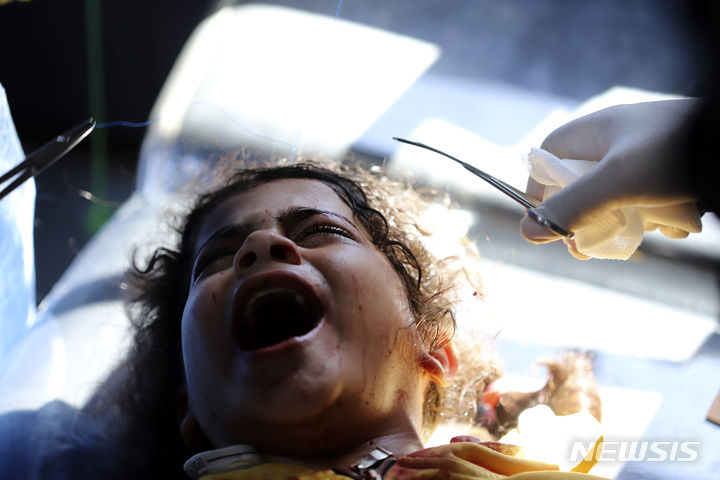 [가자지구=AP/뉴시스] 이스라엘군이 가자지구 남부 라파지역에 대한 제한적 공격에 나선 지난 7일(현지시각) 라파 난민캠프 내 쿠웨이트 병원에서 폭격으로 다친 어린이가 치료받고 있다. 미 국무부는 이스라엘의 국제법 위반 관련 보고서 발표를 연기했다. 2024.05.08.