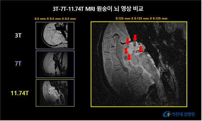 [서울=뉴시스] 7일 가천대 길병원과 가천대 뇌과학연구원 연구진은 국가영장류센터의 협력을 통해 지난 1월 15일 11.74T MRI를 이용해 살아있는 영장류(원숭이) 뇌 영상을 촬영하고 영상을 획득했다고 밝혔다. (사진=가천대 길병원 제공) 2024.06.07. photo@newsis.com *재판매 및 DB 금지