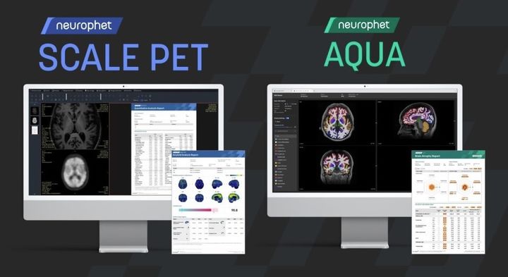 [서울=뉴시스] 11일 뉴로핏은 뇌신경 퇴화 영상 분석 소프트웨어 '뉴로핏 아쿠아(Neurophet AQUA)'와 양전자방출단층촬영(PET) 영상 정량 분석 소프트웨어 ‘뉴로핏 스케일 펫(Neurophet SCALE PET)’이 일본 건강보험 급여 가산 수가 제품으로 공식 인증 받았다고 밝혔다. (사진=뉴로핏 제공) 2024.07.11. photo@newsis.com *재판매 및 DB 금지