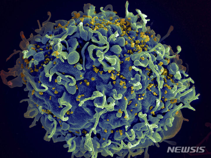 [AP/뉴시스] 미국 국립보건원 제공의 전자현미경 사진으로 푸른색의 인간 면역 T세포가 에이즈 발병의 노란색 HIV 바이러스 공격을 받고 있다 